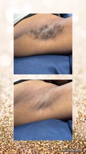 Beauty_For_Mi_Chelle_Esthetics-WorkImages_1-169x300