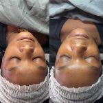 Beauty_For_Mi_Chelle_Esthetics-WorkImages_8-150x150